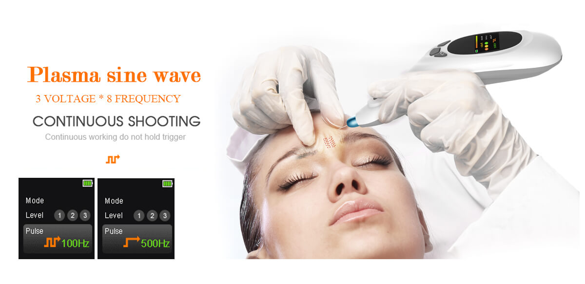 Plasma lift pen treatment frequency - Aesthetic beauty equipment - 4