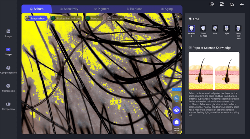 scalp sebum