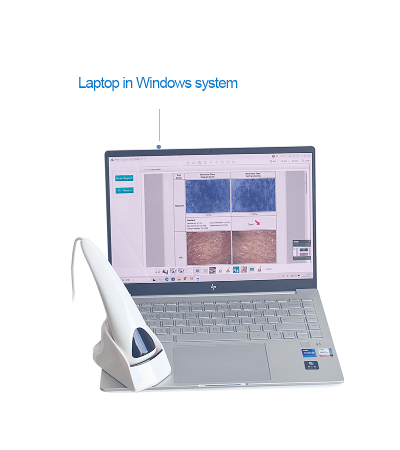 Skin analysis observed system portable equipment - News - 2