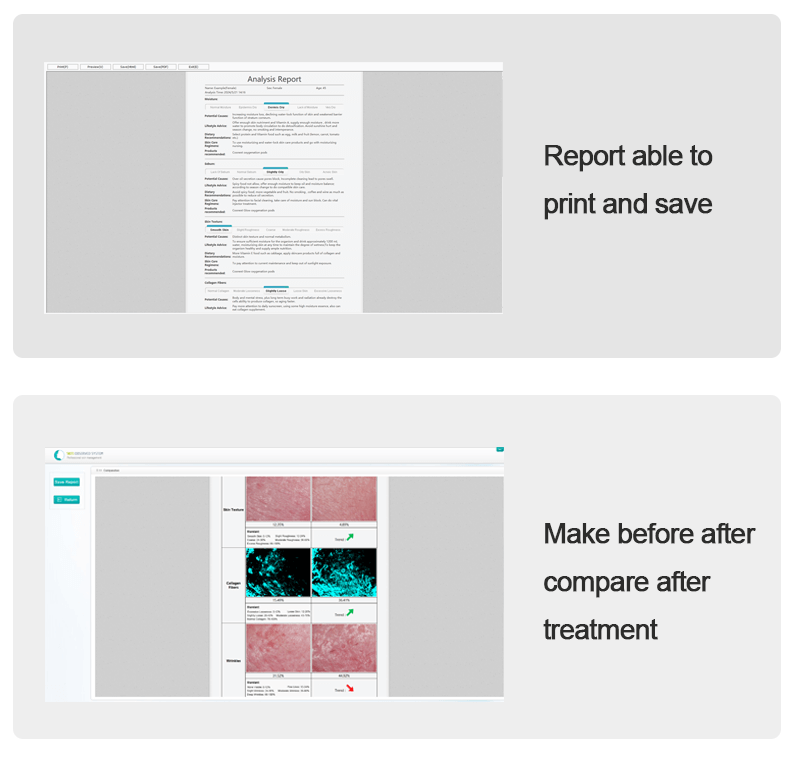 Skin analysis observed system portable equipment - News - 11