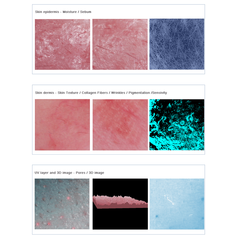 Italian skin analysis machine - News - 1