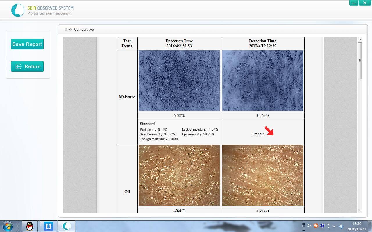 B - Needle Mesotherapy, Microneedling And Plasma Lift Factory