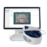 skin analyzer