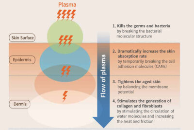 Fractional plasma and fractional laser difference - News - 1