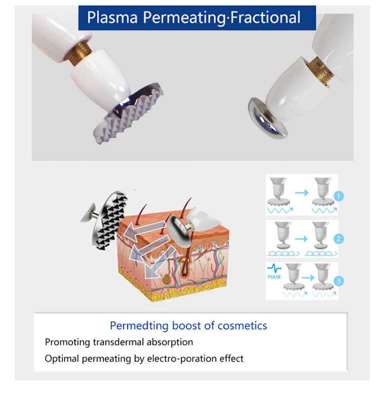 Plamere pen plasma lift -  - 10