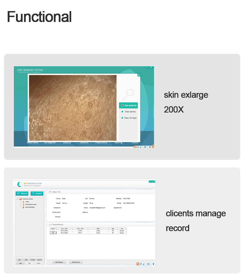 Spanish skin analyser connect with computer with report - News - 3