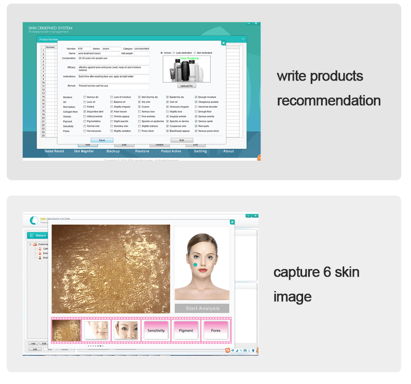 Spanish skin analyser connect with computer with report - News - 4