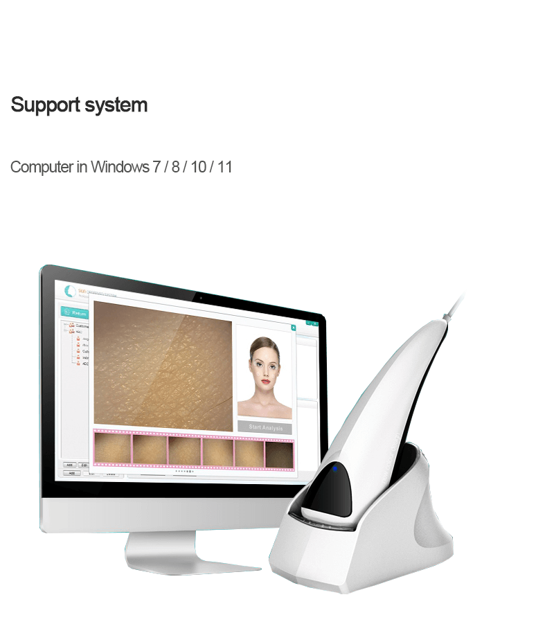 Spanish skin analyser connect with computer with report - News - 1