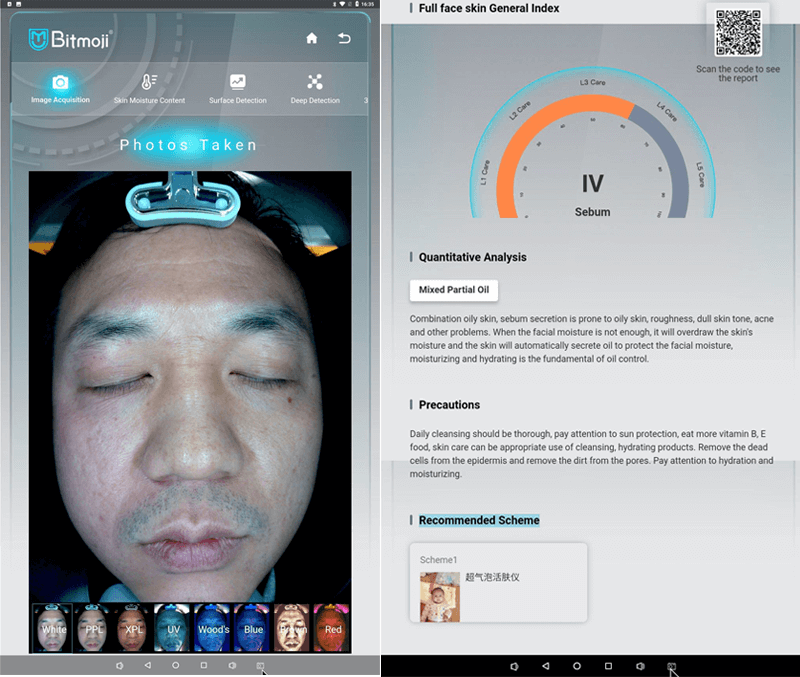 AI skin analysis machine magic mirror -  - 4