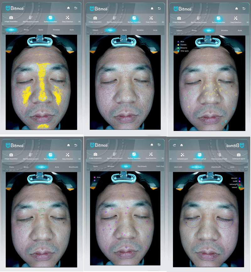 AI skin analysis machine magic mirror -  - 2