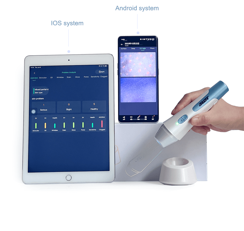 Wireless skin analysis machine connect iPad and phone use -  - 2