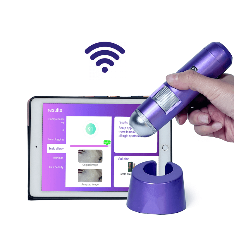 scalp analyzer