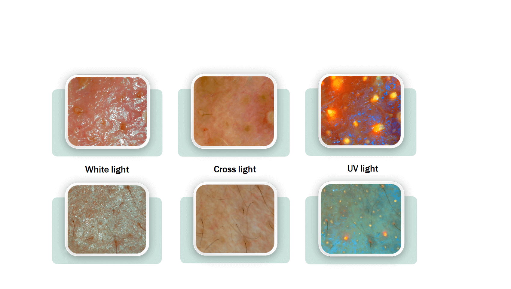 AI skin analyzer