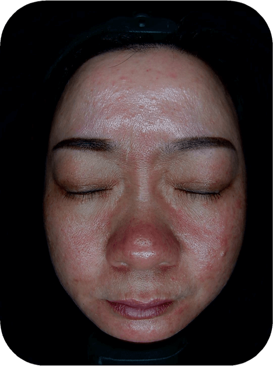 skin analysis machine