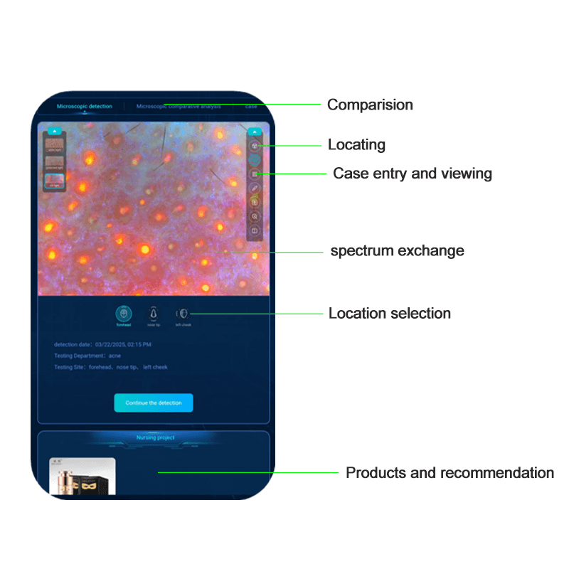 AI skin analyzer
