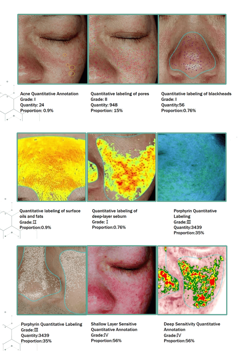 skin analyzer