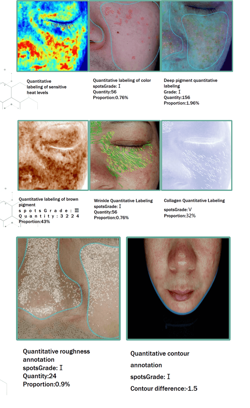 AI skin analyzer
