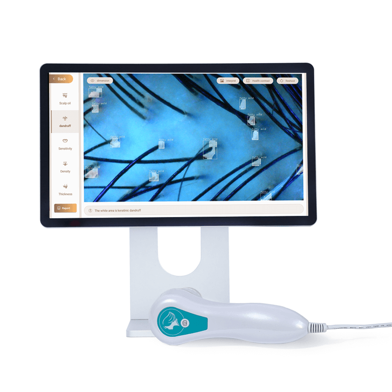 AI hair analyzer